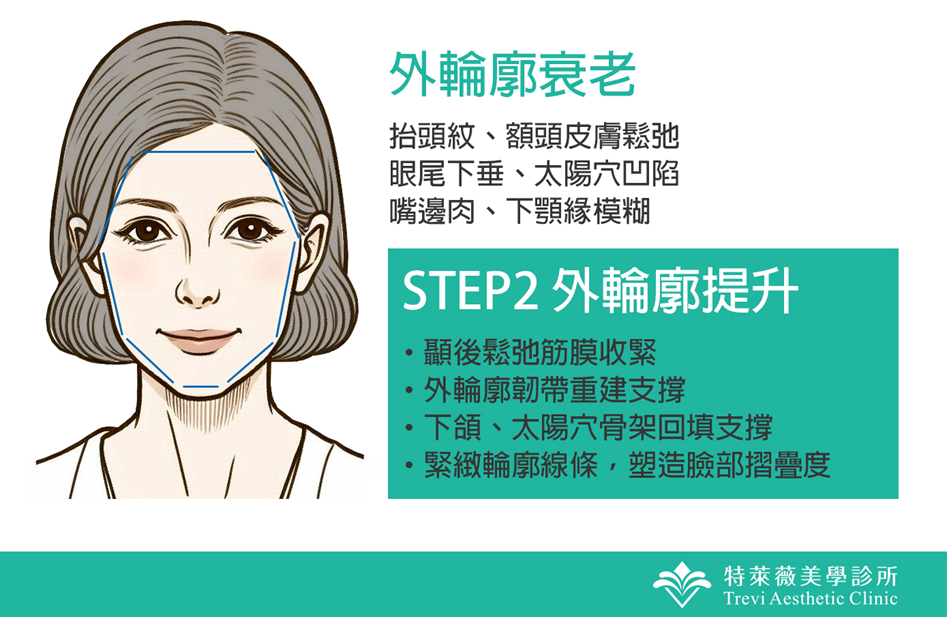 Step2外輪廓提升