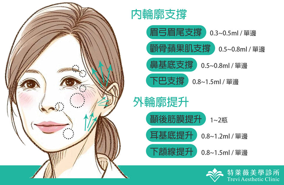 輪廓固定要用多少劑量?費用多少呢?